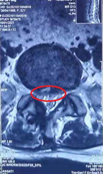 术后 MRI 1.jpg